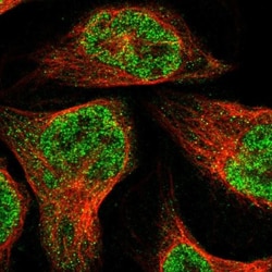 ZBTB2 Antibody, Novus Biologicals 0.1mL; Unlabeled:Antibodies, Polyclonal